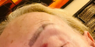 Laura Bozzo sufrió caída durante un ataque de ansiedad