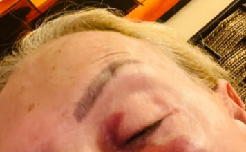 Laura Bozzo sufrió caída durante un ataque de ansiedad