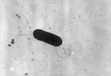 Brote de una bacteria deja varios muertos en el estado de Washington