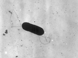 Brote de una bacteria deja varios muertos en el estado de Washington