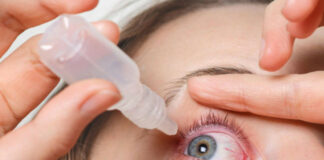 Especialista advierte no automedicarse por conjuntivitis por riesgo de ceguera