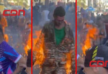 Fallece otro de los niños ingresados por quemaduras en carnaval de Salcedo