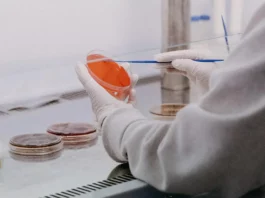 Médicos llaman a no alarmarse ante posibles casos de ántrax en Haití