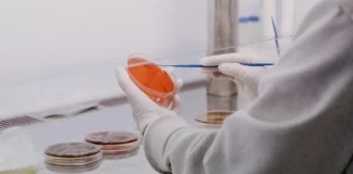 Médicos llaman a no alarmarse ante posibles casos de ántrax en Haití