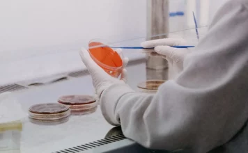 Médicos llaman a no alarmarse ante posibles casos de ántrax en Haití