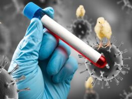 Estados Unidos reporta su primer caso de gripe aviar sin contacto conocido con animales